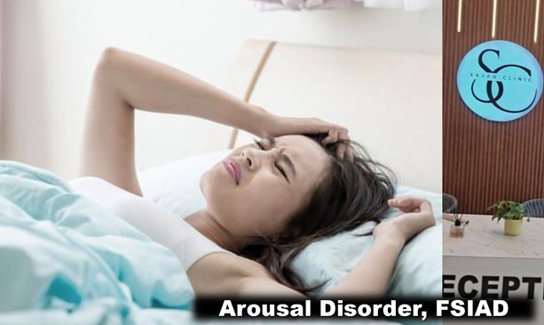 arousal disorder in women