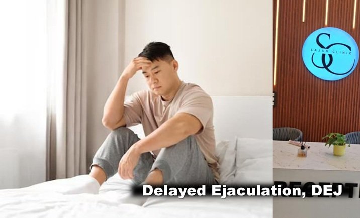 dealyed ejaculation